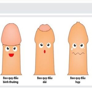 Cat Bq Huong Dan Truoc Va Sau Cat